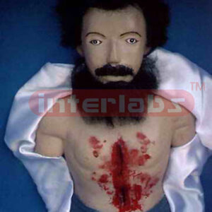 Homicidal stab wound of the chest