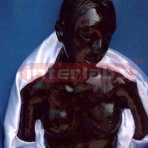Lightning injuries