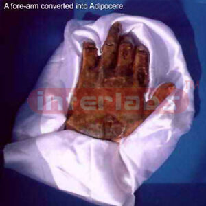 A hand converted into an adipocere