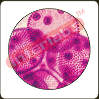 Volvox w.m.